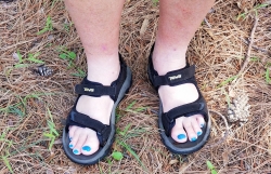 Click to view Toenails.jpg